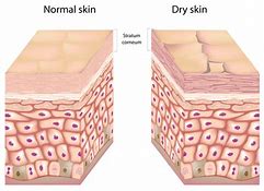 Healthy Moisturized Skin vs. Damaged Dry Skin